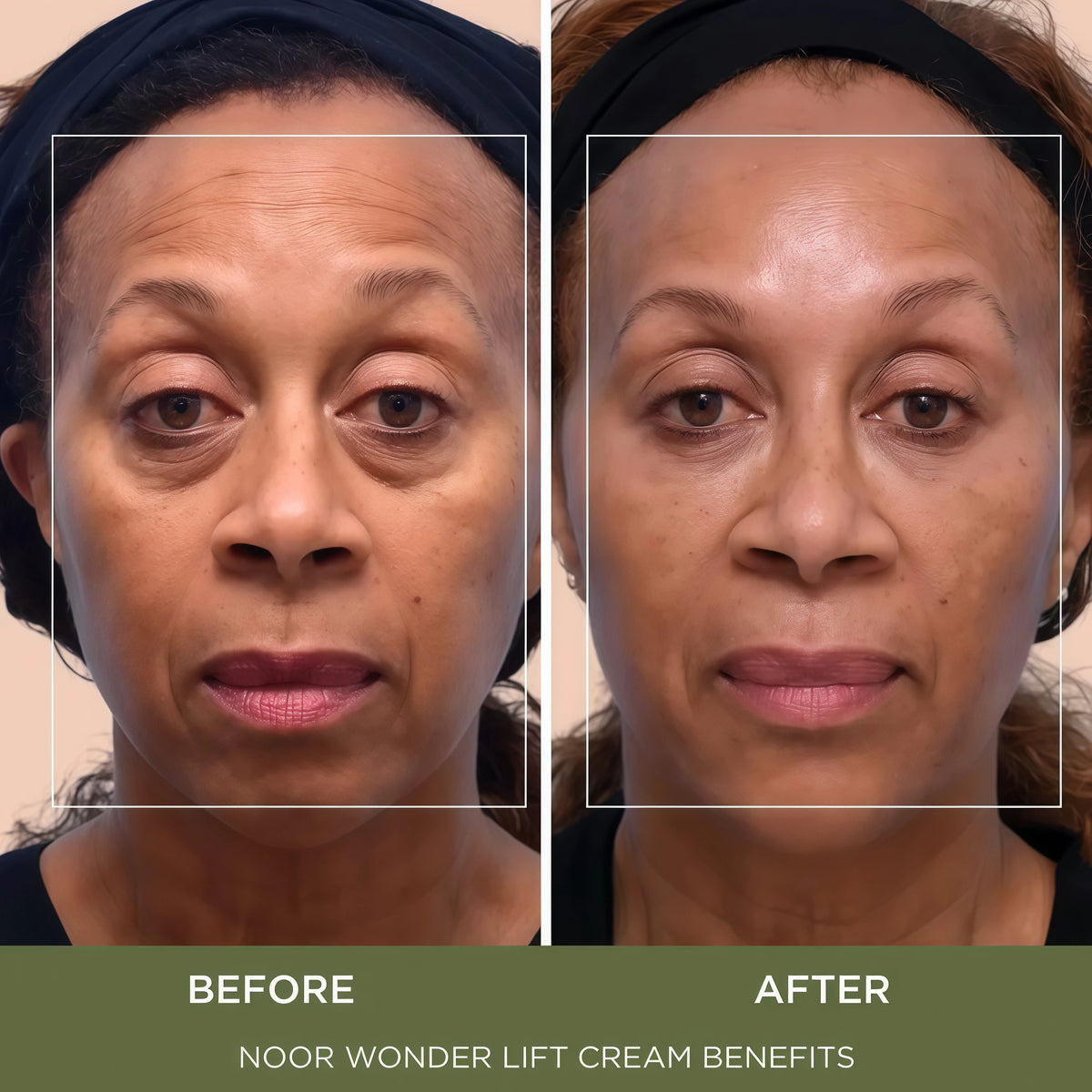 Noor Wonder Lift Cream for Women, Natural Anti-Aging Wrinkle teatment with Syn-Ake natural blend Promotes Anti Aging and Significantly Less Wrinkles In As Little As A Few Days